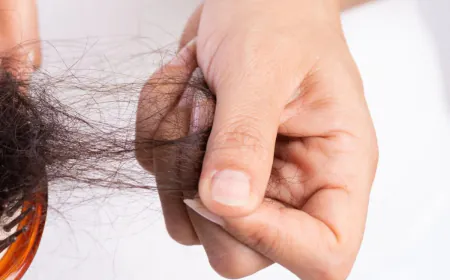 Causes Of Hair Loss, Homeopathic Remedies For Hair fall